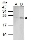 Anti-PUMA antibody [C2C3], C-term used in Western Blot (WB). GTX109675